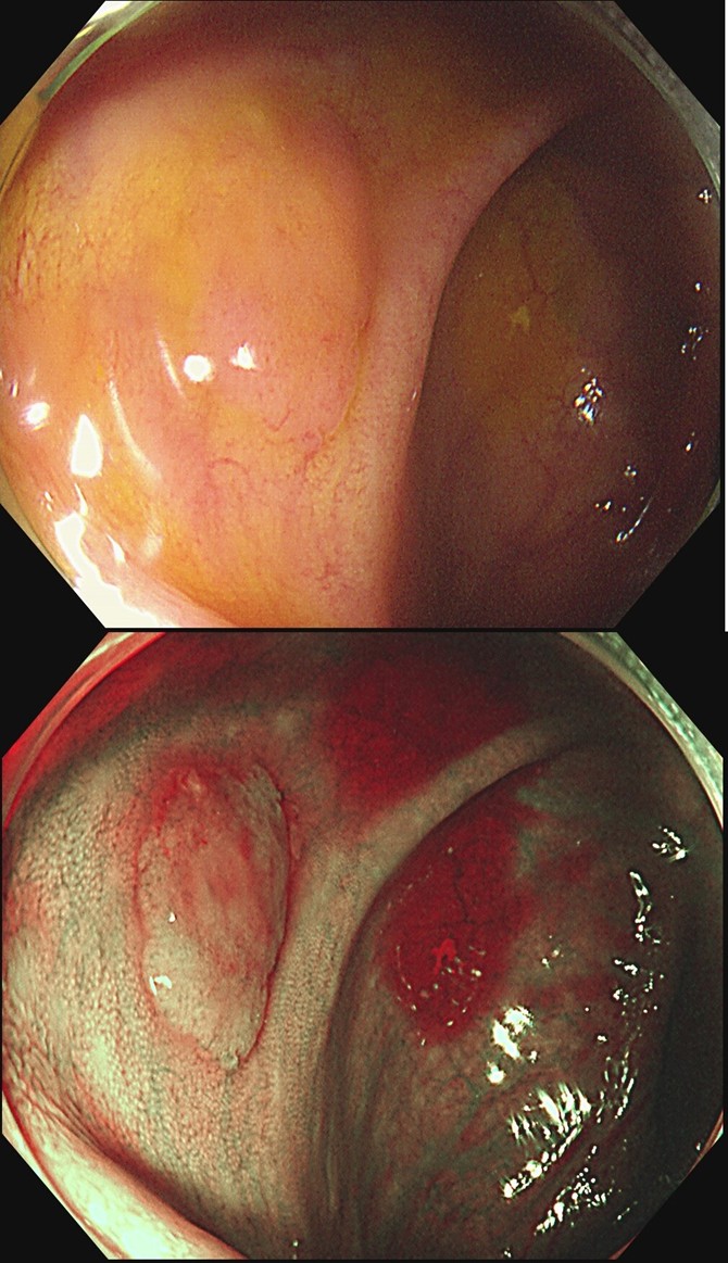 ac33a460fa27a57b2e918894626a4406_1762759549_896.jpg ac33a460fa27a57b2e918894626a4406_1762759549_896.jpg