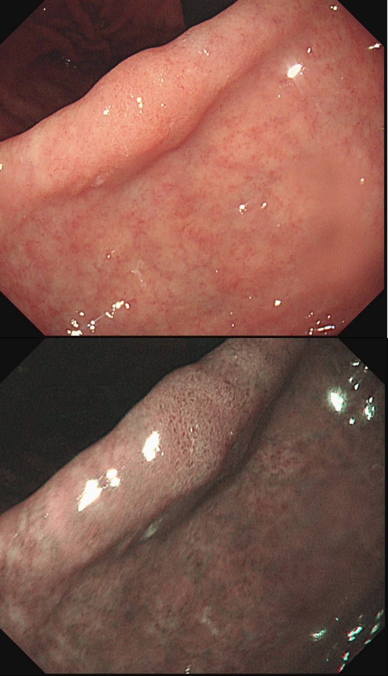 c89edc5bd65bd61ca3b4d7bd8712367c_1762938721_5791.jpg c89edc5bd65bd61ca3b4d7bd8712367c_1762938721_5791.jpg